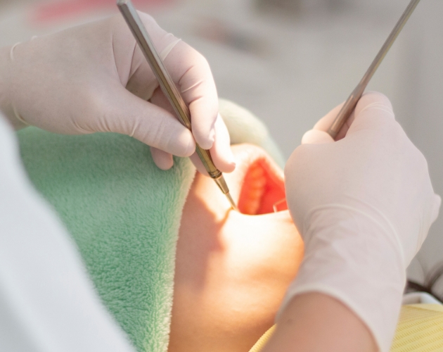 インプラントはメンテナンスも重要です