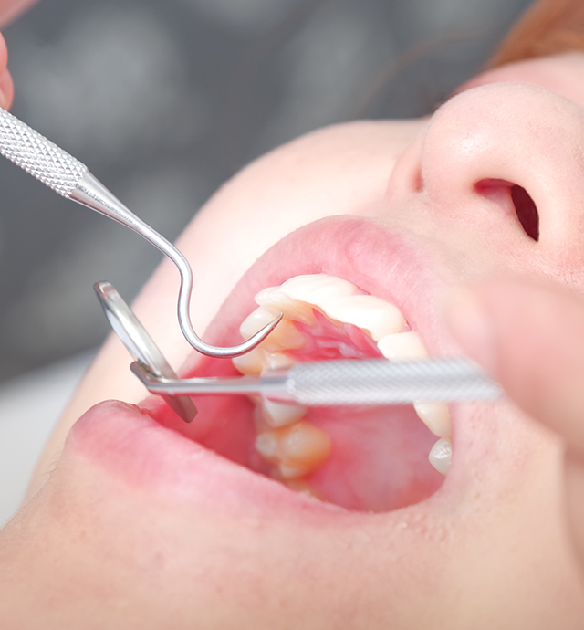 初期治療(必要な方のみ)