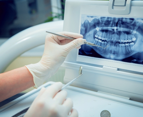 親知らずなどの抜歯や歯周外科治療にも対応しています