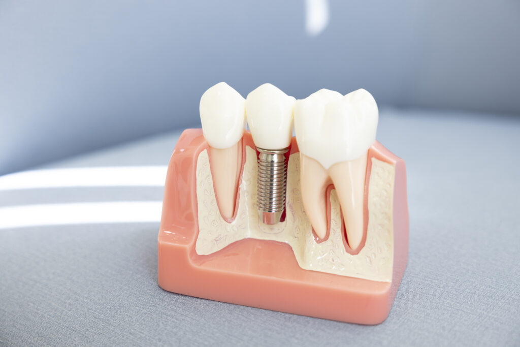 治療にかかる費用と医療費控除制度について